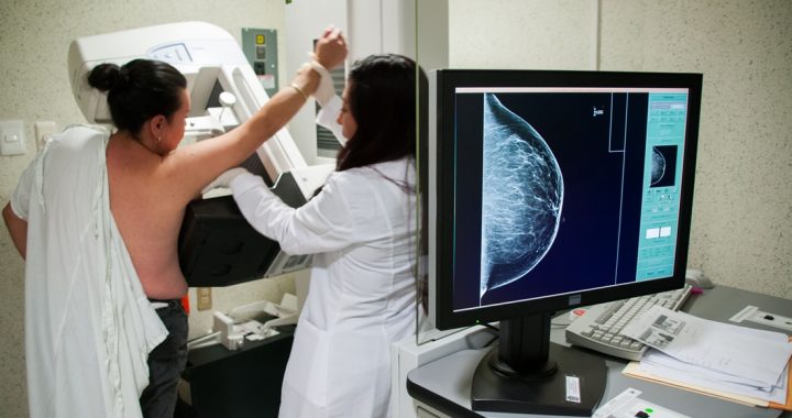 PROMUEVE SALUD EDOMÉX DETECCIÓN OPORTUNA DE CÁNCER DE MAMA