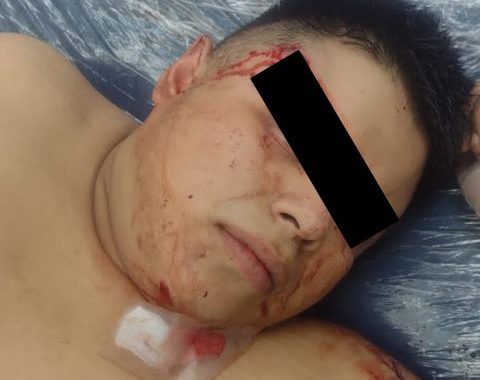*UN POLICÍA FUE HERIDO POR ARMA DE FUEGO RESULTADO DE UN ENFRENTAMIENTO DONDE SE FRUSTRÓ EL ROBO DE UN VEHÍCULO, TAMBIÉN UN PROBABLE ASALTANTE PRESENTÓ LESIONES DE BALA*